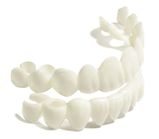 Snap-On Veneers – Instant Smile Makeover for a Perfect Smile