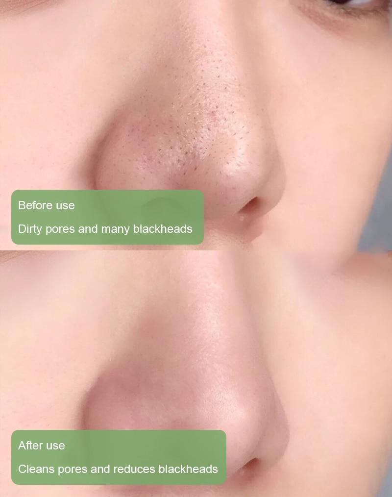 PurifyMist™ — Deep Clean Pores, Reduce Excess Oil & Refresh Dull-Looking Skin
