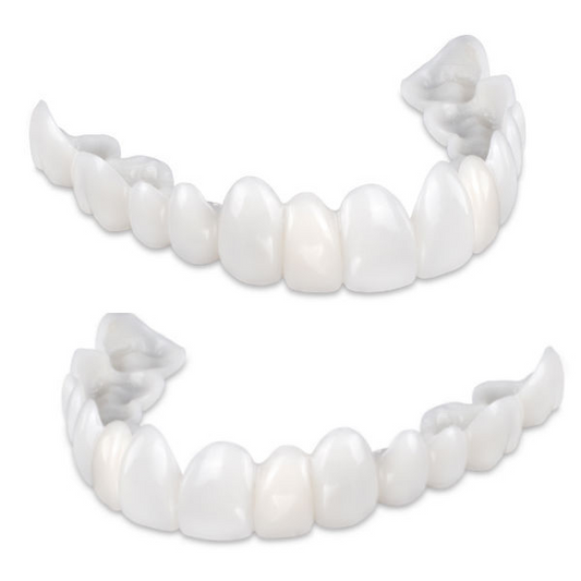 Snap-On Veneers – Instant Natural-Looking Smile in Seconds